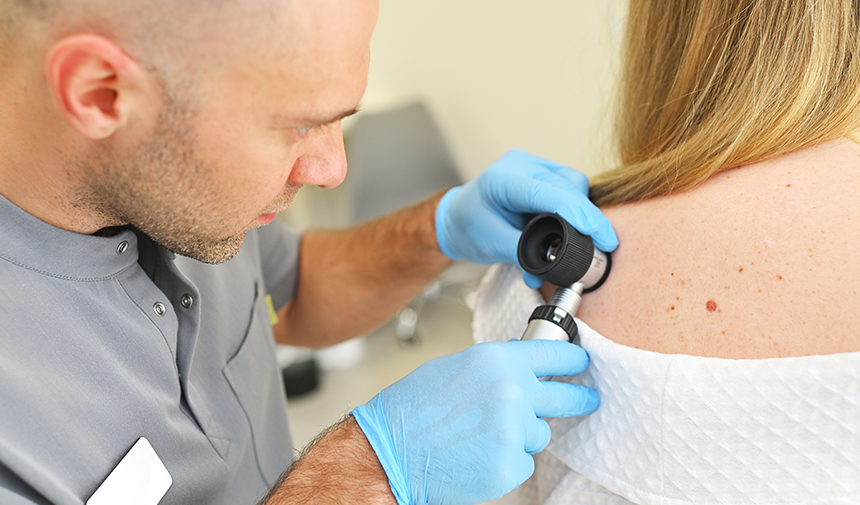 New Symptom in Skin Cancer, Melanoma Risk of Newly Formed Moles